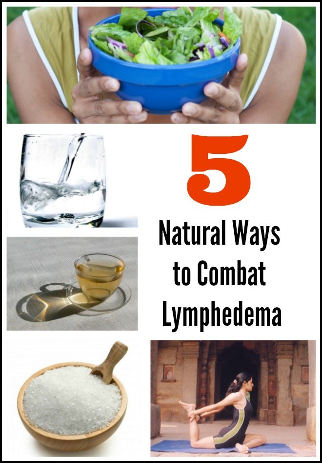 Lymphedema can be quite uncomfortable and hard to manage at times.