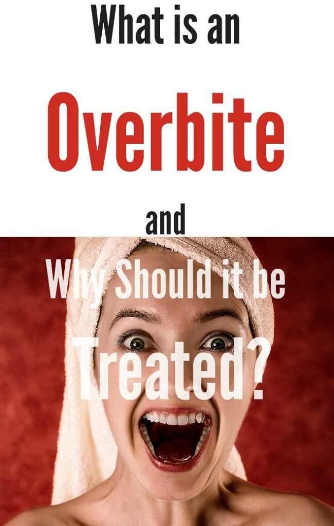 What is an Overbite and Why Should it be Treated?
