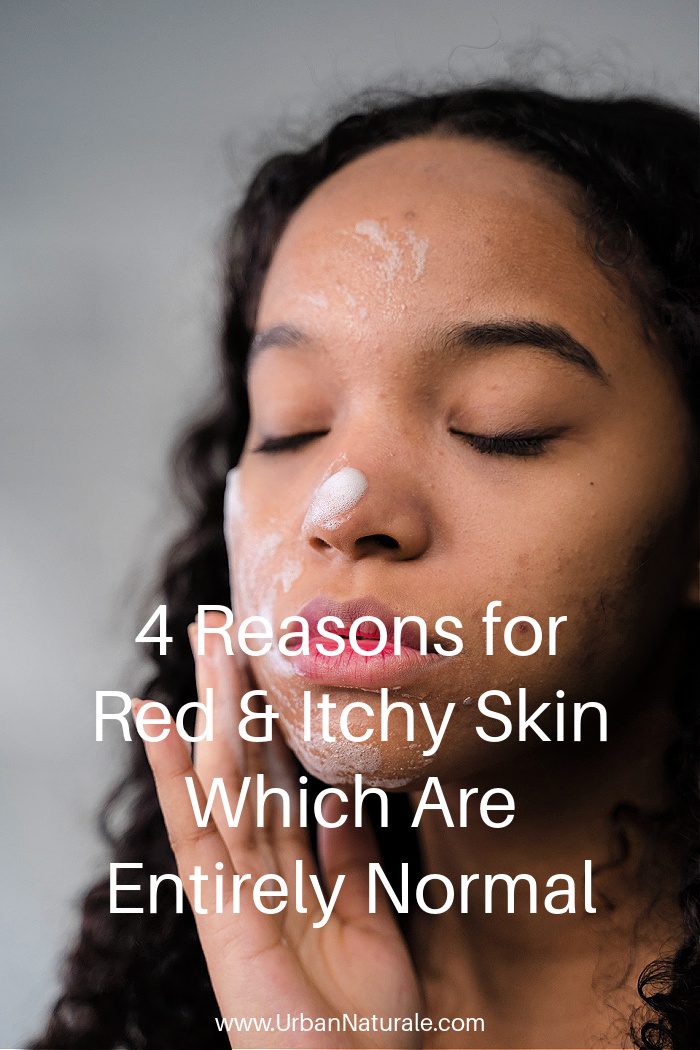  4 Reasons for Red & Itchy Skin Which Are Entirely Normal - If you suddenly discover a new and sudden skin rash, here are four common reasons why a patch of red and itchy skin has appeared.  Reasons may include hormonal changes, allergies, insect bites, psoriasis, eczema and more.   #skin  #skinrash  #itchyskin  #redskin  #skinproblems  