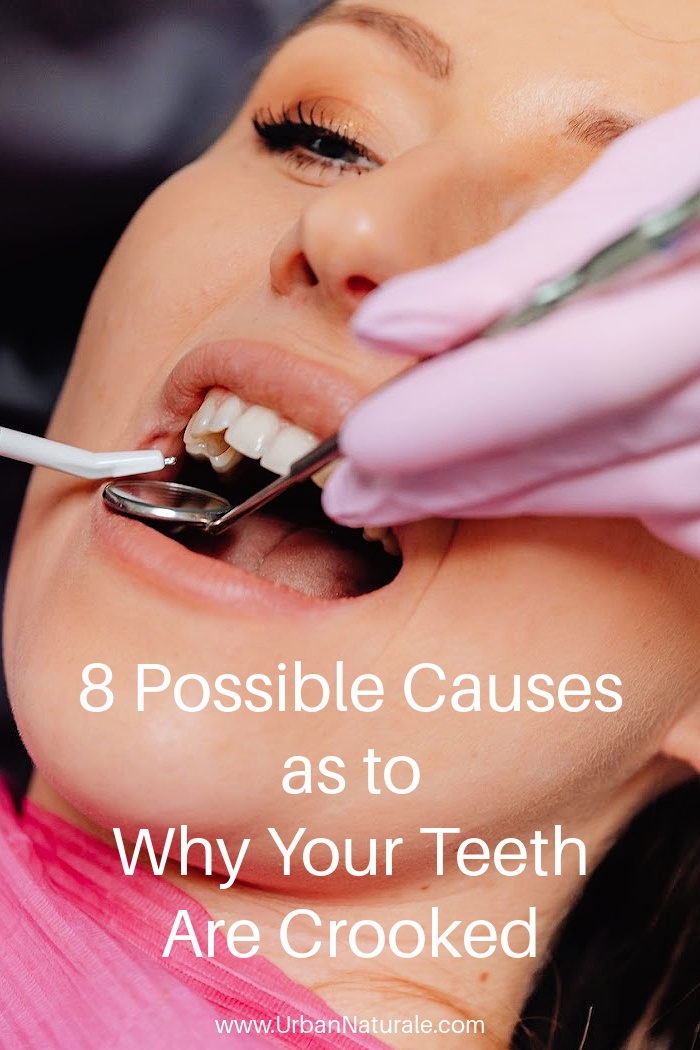 8 Possible Causes as to Why Your Teeth Are Crooked - Knowing the possible causes of crooked teeth and seeking prompt dental or orthodontic treatment will prevent significant alignment issues from arising. #teeth  #crookedteeth #dental  #orthodontics